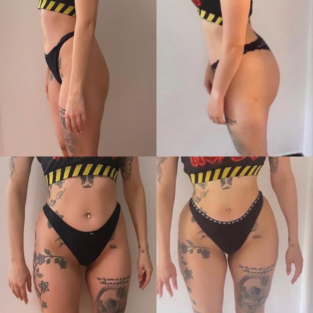 Vanessa — 3-month transformation